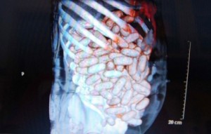 Saisie de drogue dure à l’aéroport de Bamako-Sénou : 1,200 kg de cocaïne découvert dans le ventre d’un Nigérian