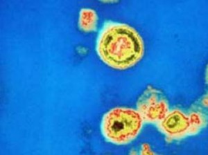 Vih Sida: Zéro transmission d’ici 2019 : Le plan national d’élimination de la transmission Mère-Enfant a été lancé, hier